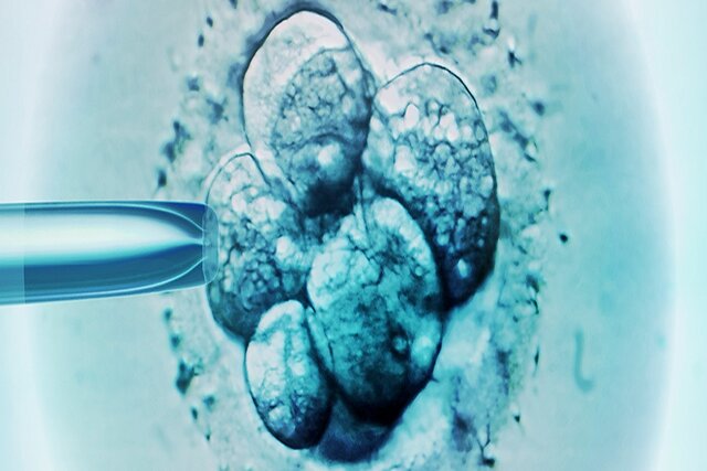   اولین نوزاد استرالیایی با روش جایگزین IVF متولد شد