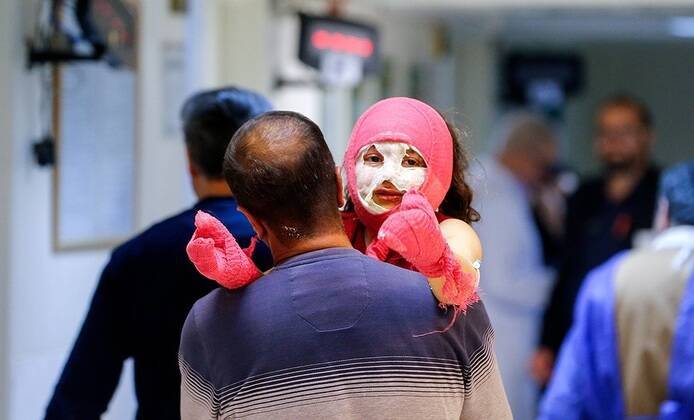  ۱۸۱ مصدوم و ۶ فوتی در حوادث چهارشنبه‌سوری / از بین مصدومان ۱۵ نفر دچار قطع عضو و ۶۷ نفر از ناحیه چشم آسیب دیده‌اند